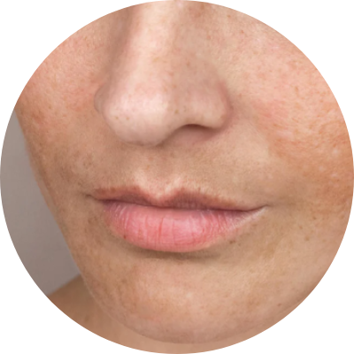 Derma led Indian skincare